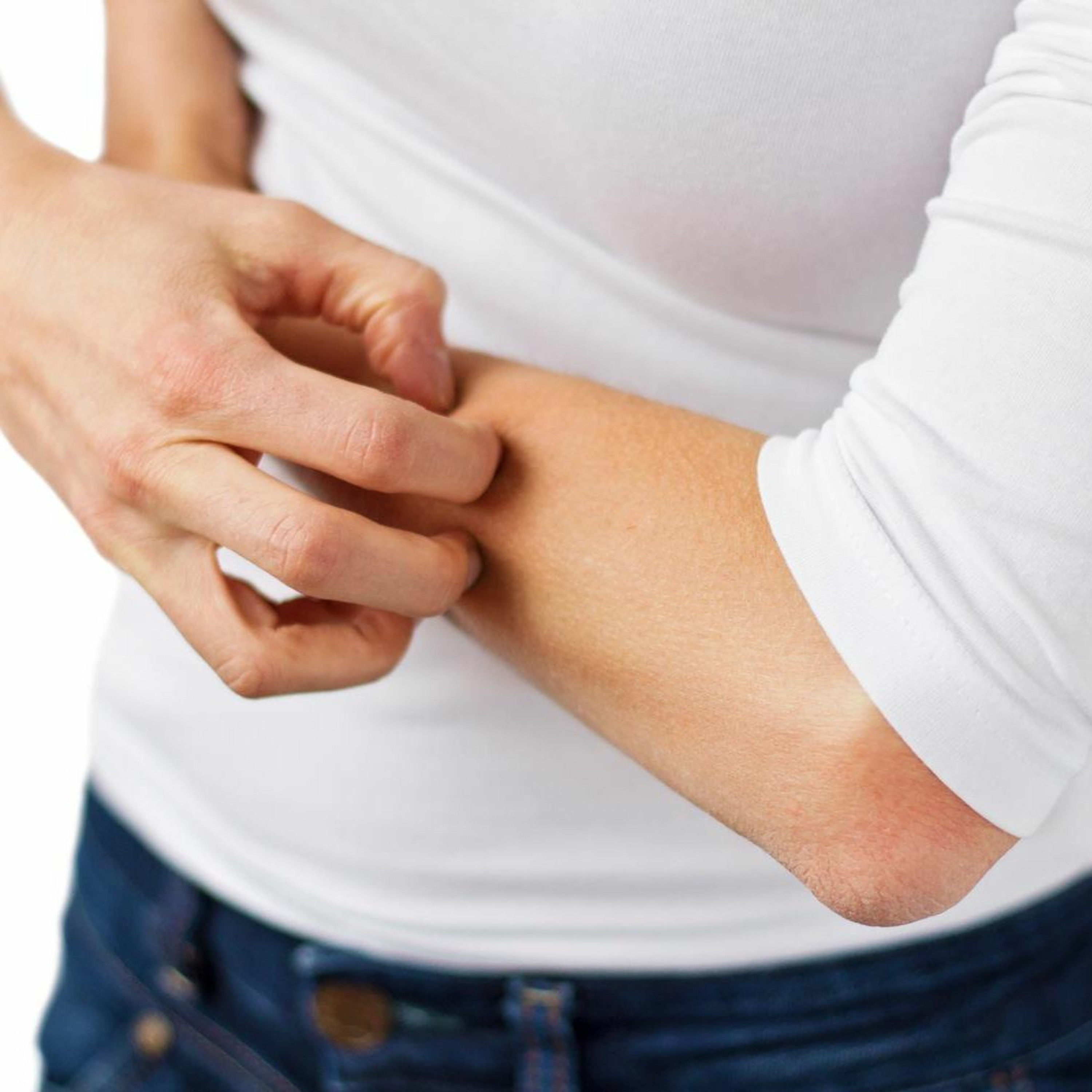 cover of episode Healing Acne, Eczema & Psoriasis - Radio Show Archive