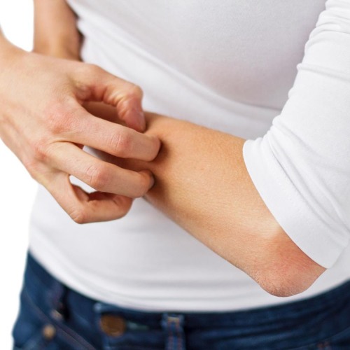 Дермопатия диабетическая фото лечение Healing Acne, Eczema & Psoriasis - Radio Show Archive by Medical Medium