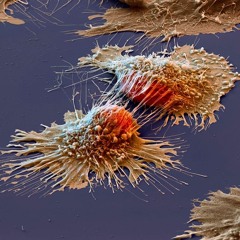 YogaFromHell - โรคร้าย