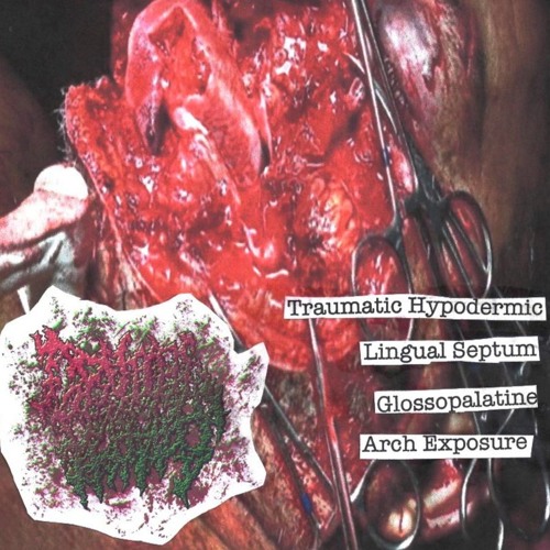 Genital Herpes - Untitled 3 Tracks