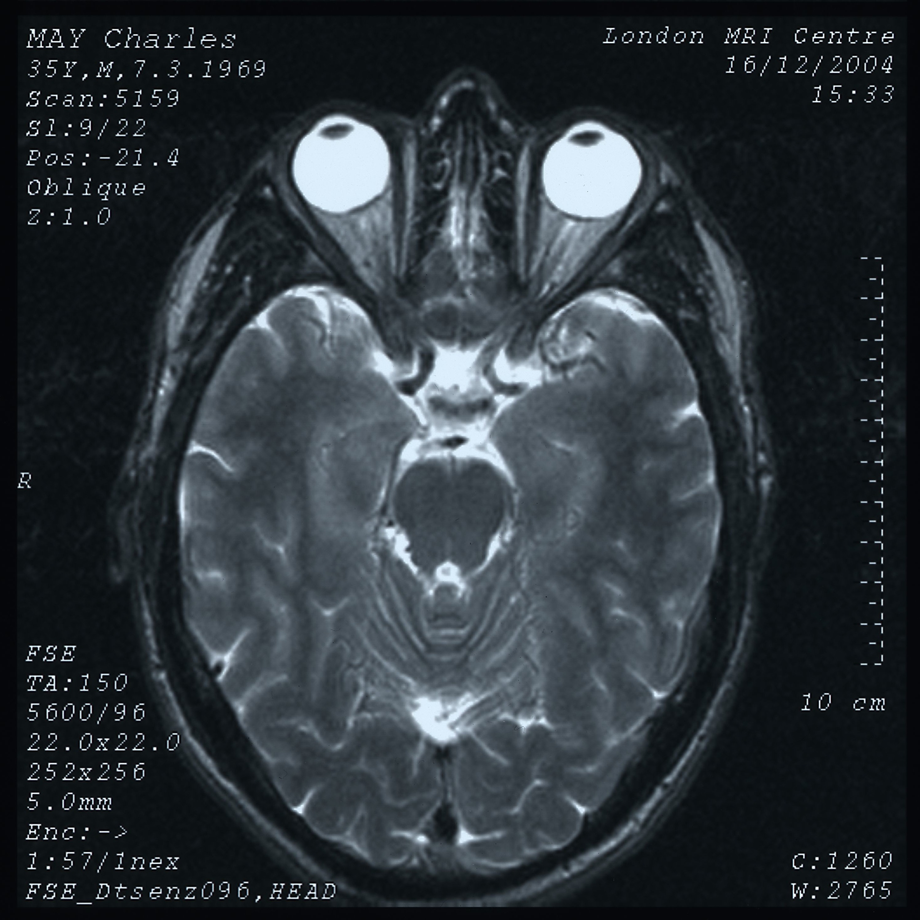 head first episode artwork