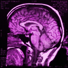 My Left Frontal Lobe by Brett William Dietz