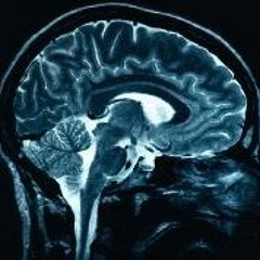 Cerebral Losses (Old Track)