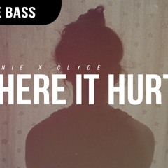 Bonnie X Clyde- Where It Hurts ( Nuckingfutz Remix)