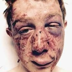 Something to relate to that viscious circle