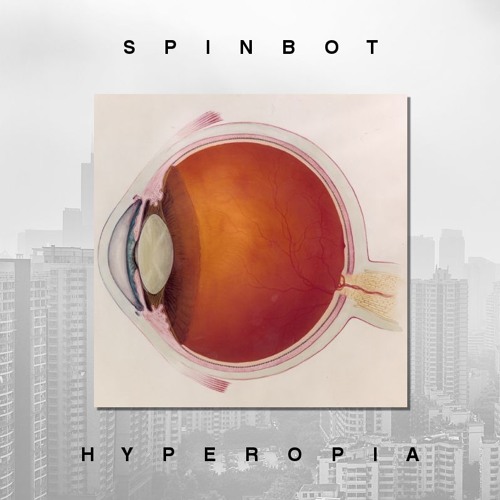 Hyperopia