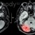 Artwork for GYMLAIRD 06 - Dr. Tim Rogers - Brain Injury and Stress Management
