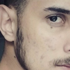 Without Me - Eminem [COVER]