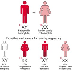 A Rare Case Of Female Haemophilia