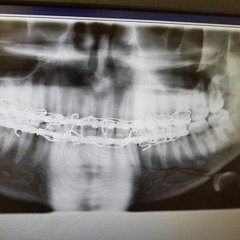 Wired Shut  :Rockburn