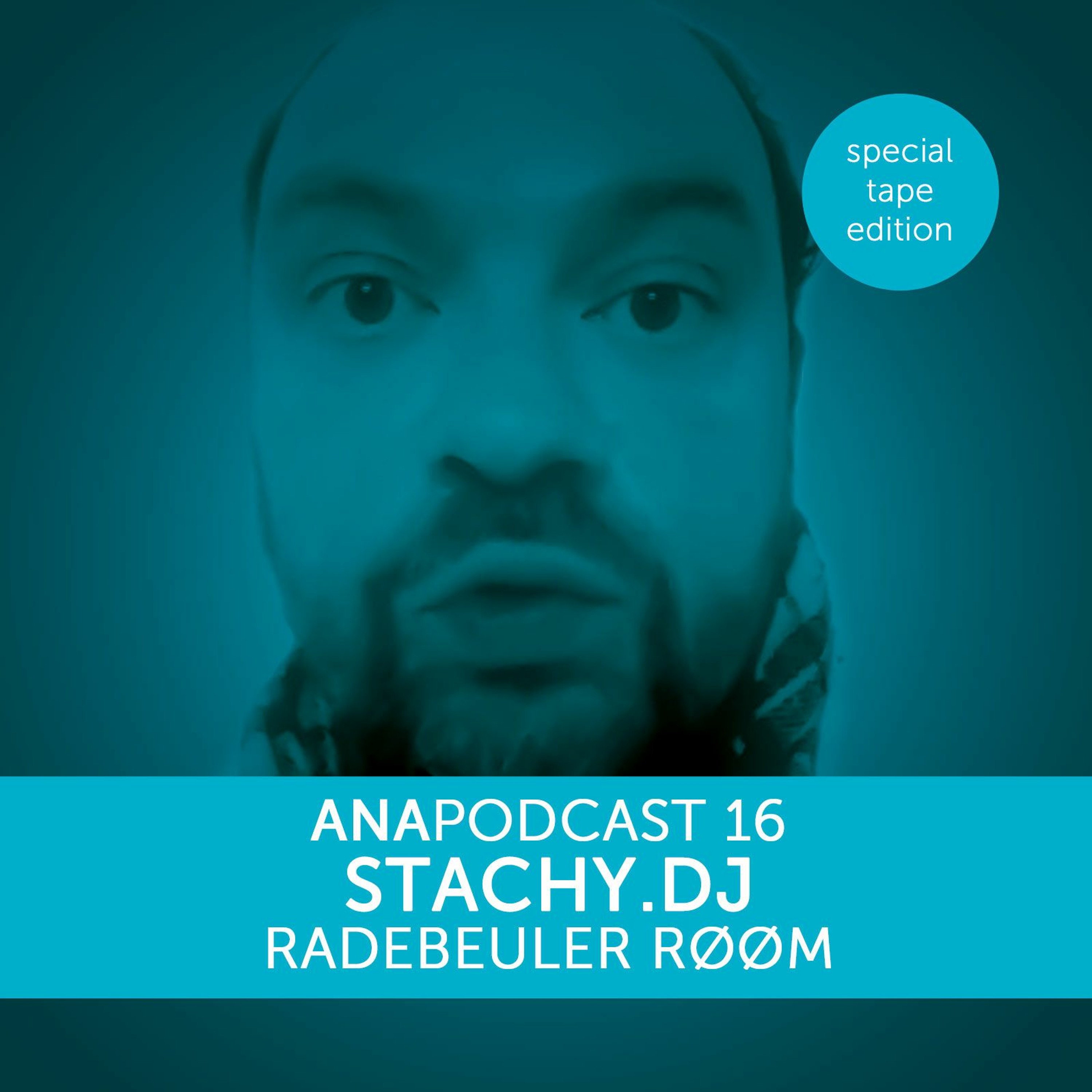 o cholera, to ja. STACHY.DJ