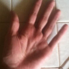 Why Does It Hurt When I Pee?