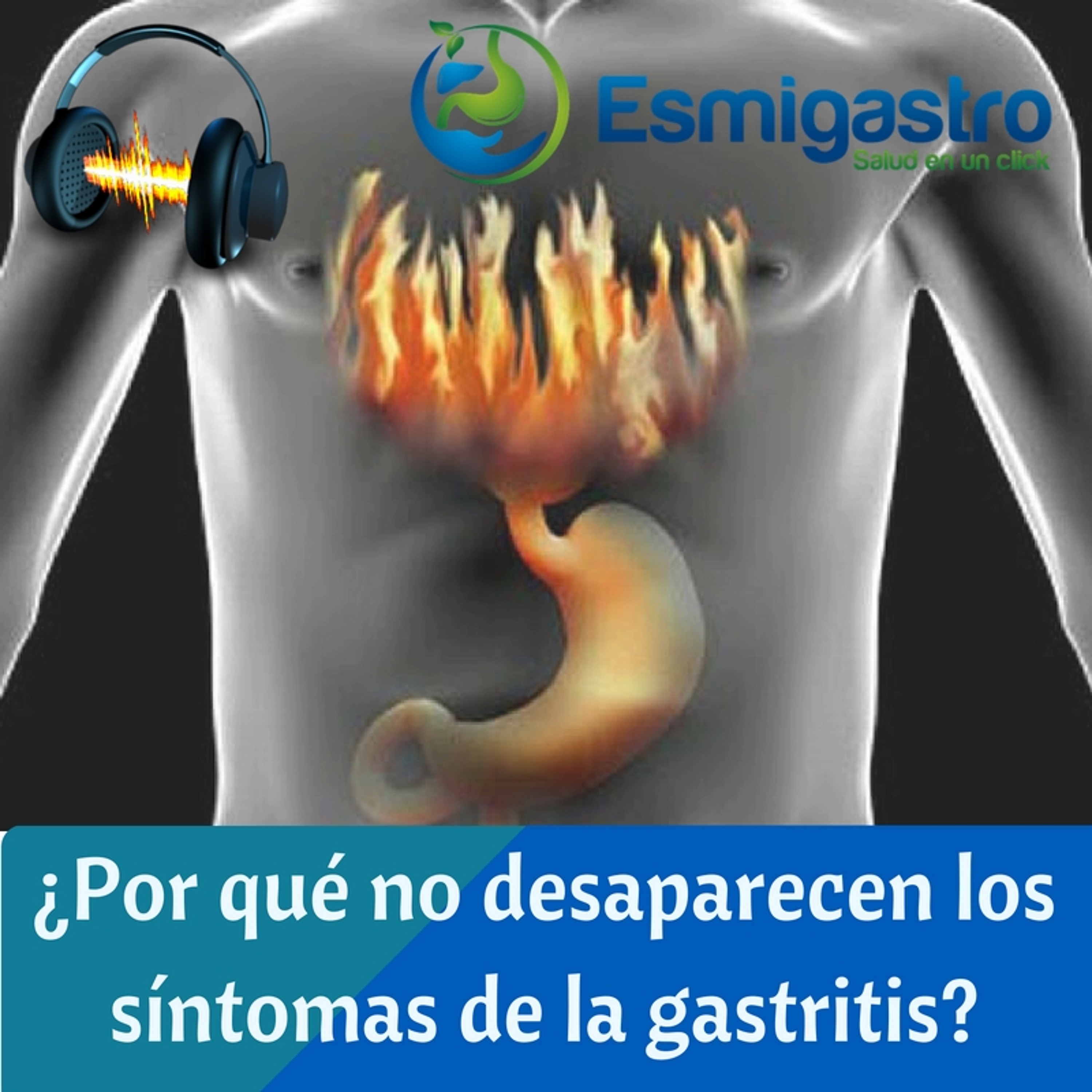 ¿Por qué no desaparecen los síntomas de la gastritis? episode artwork