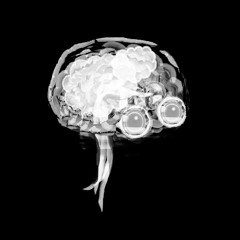 This particular machine is a mind-machine interface device