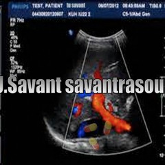 T.U.Savant savantrasound