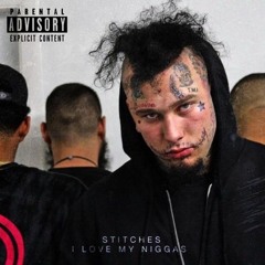 Stitches I Love My Niggas #TMI #FuckAJob