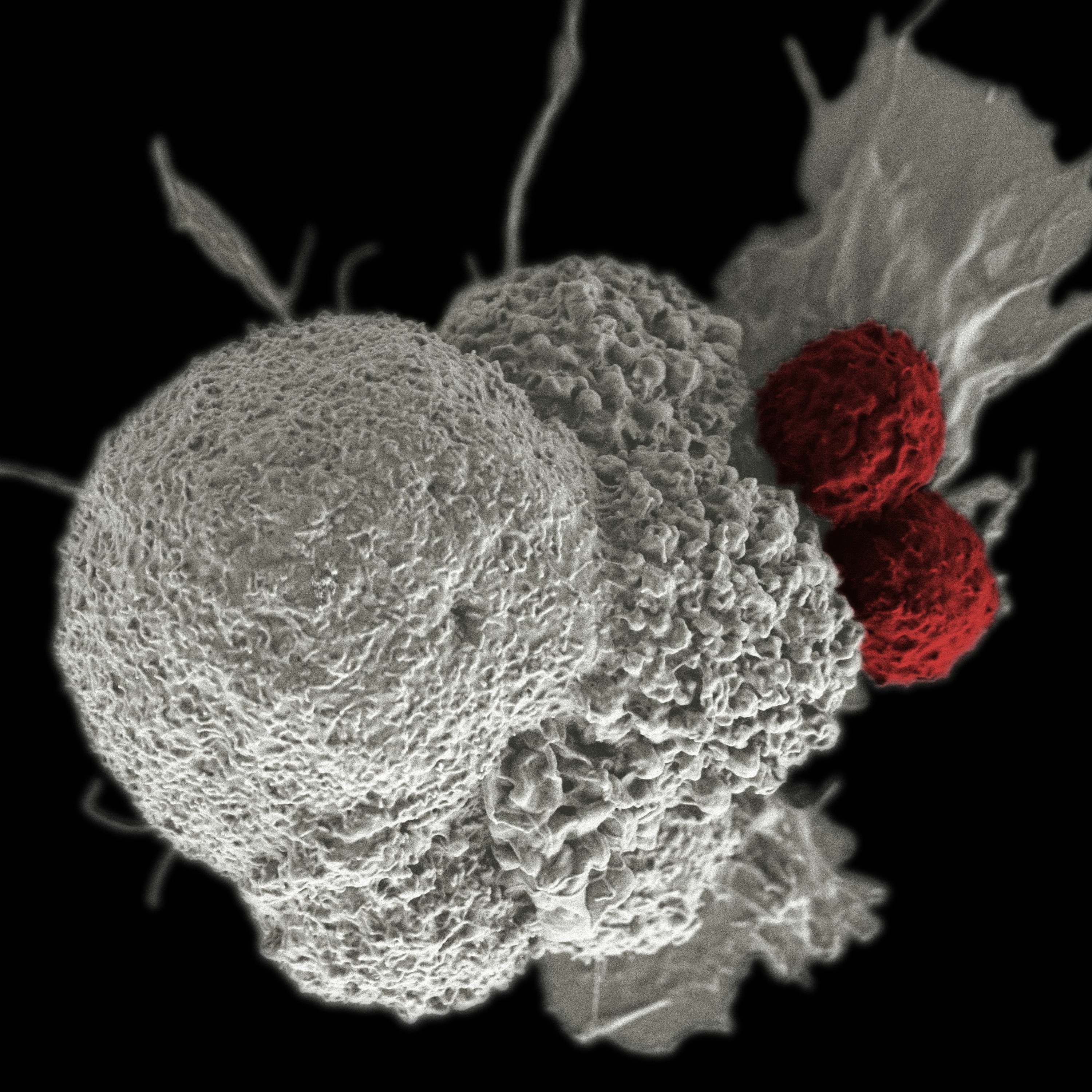 n=9 Cancer immunotherapy part 2: On the cusp of something great