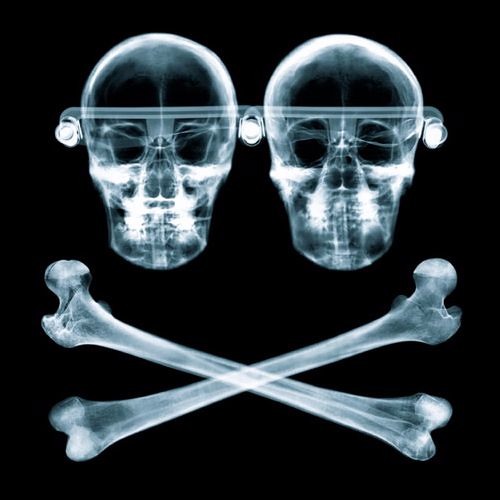 Orbital - Chime (Chris Craig Remix) - Free Download!