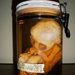 Thing In A Jar