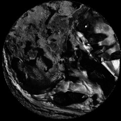 [MR000.0] B2. Brazen Bull (Ontal Remix)