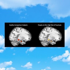 Intermittent Physical and Psychological Abuse