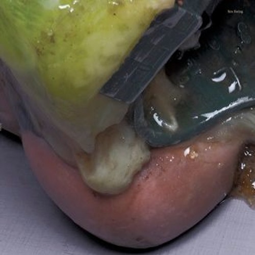 in tune with the song of a fish