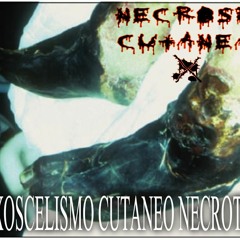 7.NxCx - (LOXOSCELISMO CUTANEO NECROTICO)