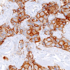 Aphex Twin - XTAL (Toasty Zone Remix)