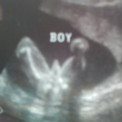 Mixed Feelings...$RICO$