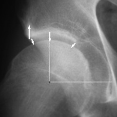 space hip (wou wou & the wormling open collab)