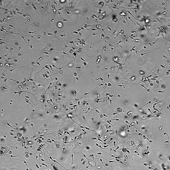 Nitrogen l.
