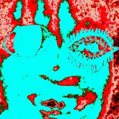 Flattened Cerebrum