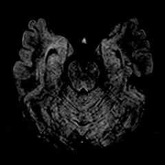 F.R.A.N - Dozi (original Mix)