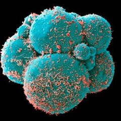 Debielio - Don't Tease Me