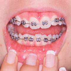 Teeth (prod. John Madden)