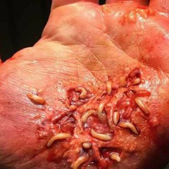 Agitated Screams Of Maggots Cover