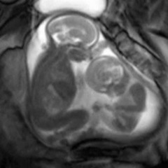 Fossil-Figures by Joyce Carol Oates