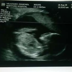 "Kylee" (10ToesChallenge)