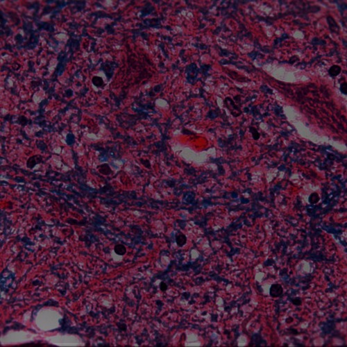 Screaming Goat Remix