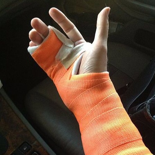 WRIST