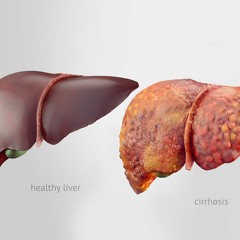 The Intern Series - Liver Disease & Dietetics Research