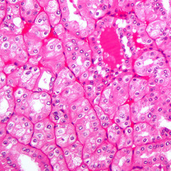 fallout [basement version]