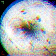 Radial Arch