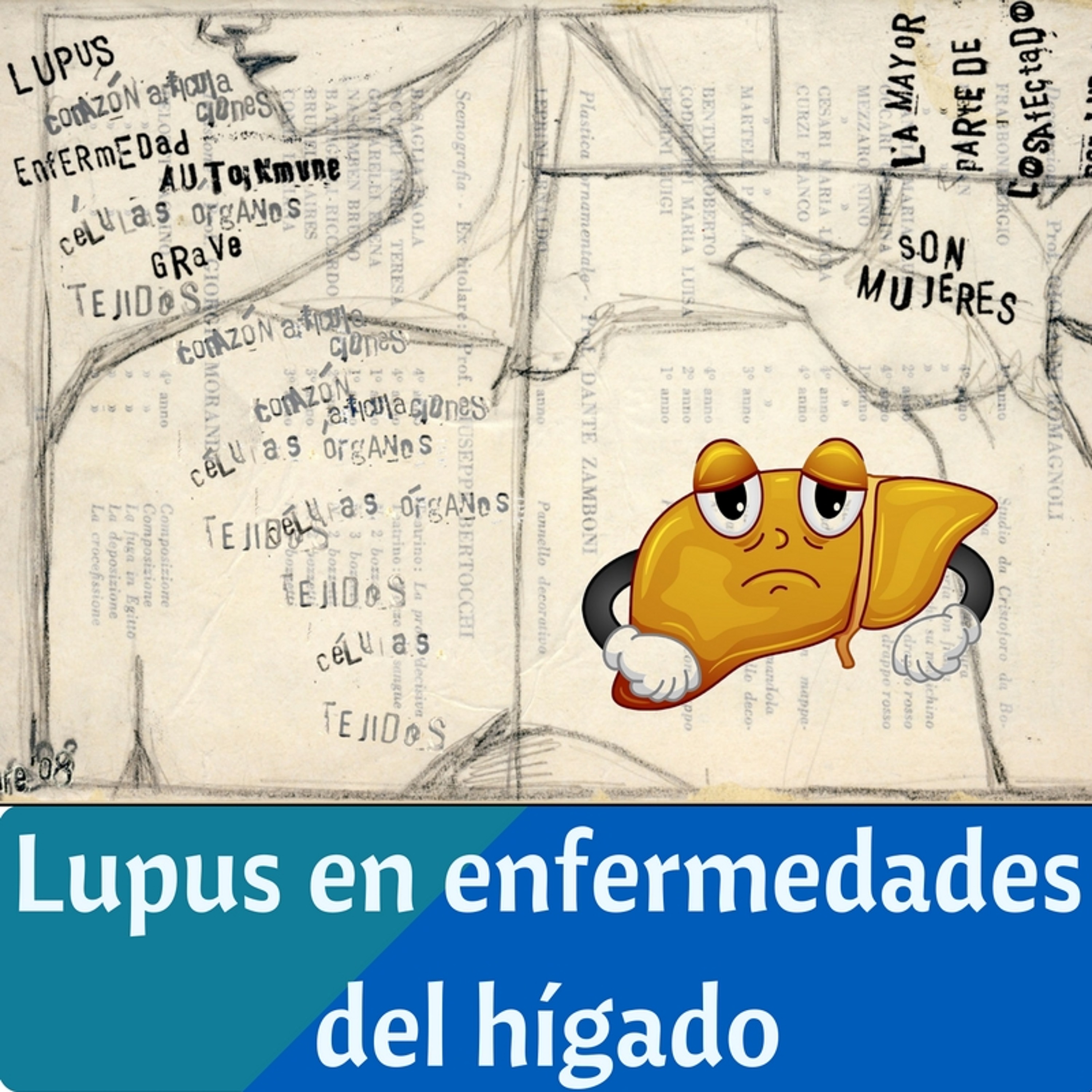 Lupus en enfermedades hepáticas episode artwork
