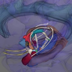 MICHEL DES AIRLINES-----UNCUS