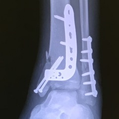 Ep 12 - Shock in Joshua Tree - David