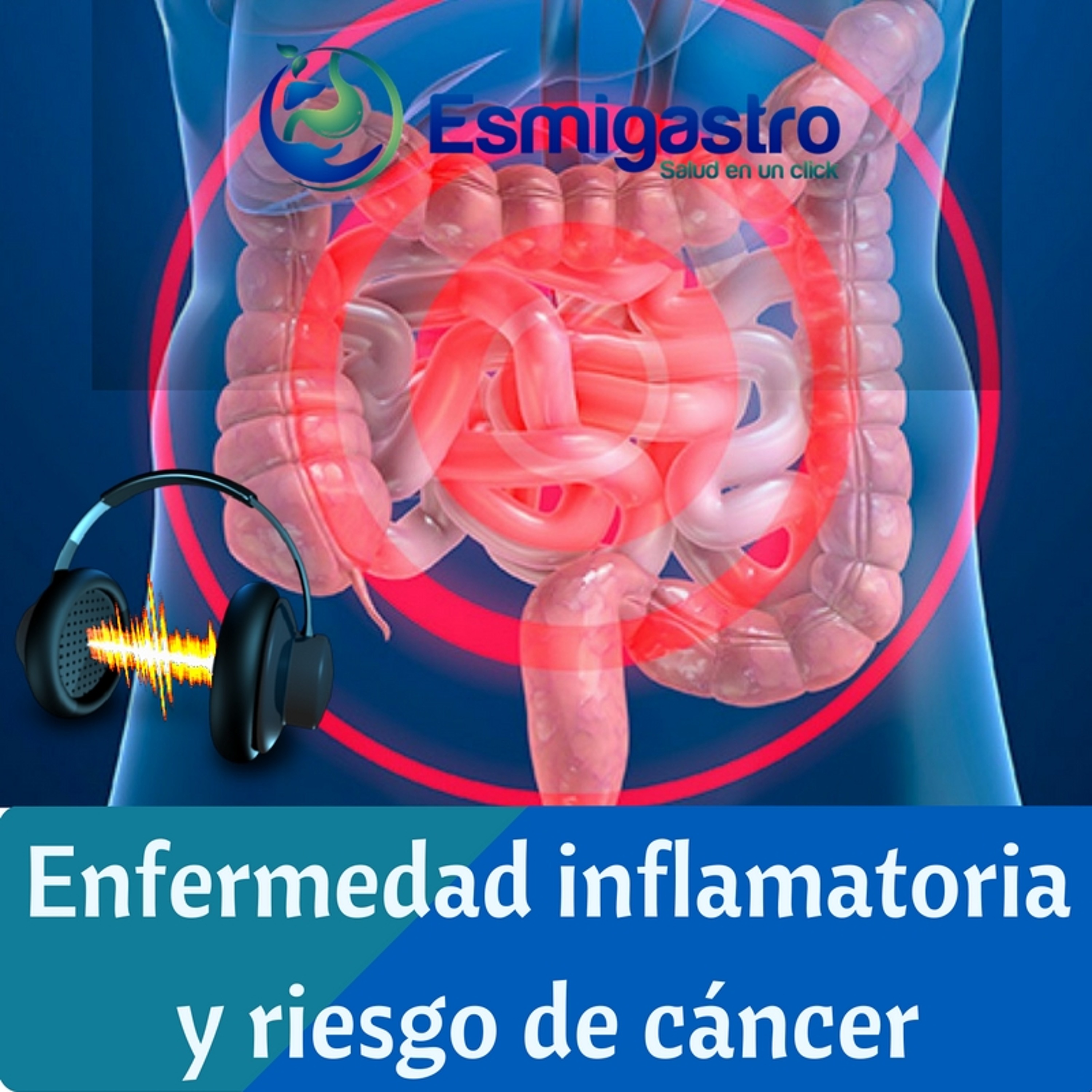 Enfermedad inflamatoria y riesgo de cáncer episode artwork