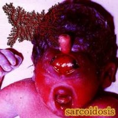 VISCERA INFEST - Urticaria Penicilina Maligna