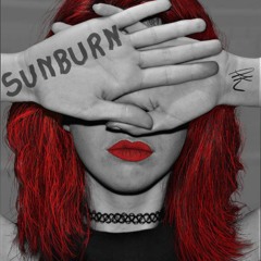 Sunburn