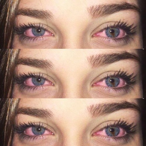 2️⃣0️⃣1️⃣7️⃣🚺🚹